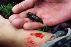 螞蟥咬人怎么辦？螞蟥怎么能殺死？